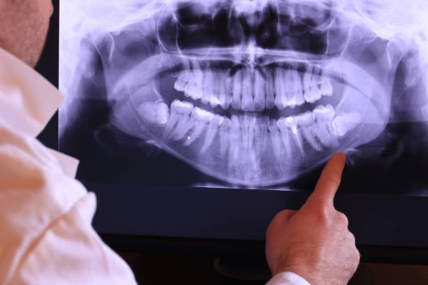 Best Emergency Dental Care for Trauma or Injury in Hanahan, SC