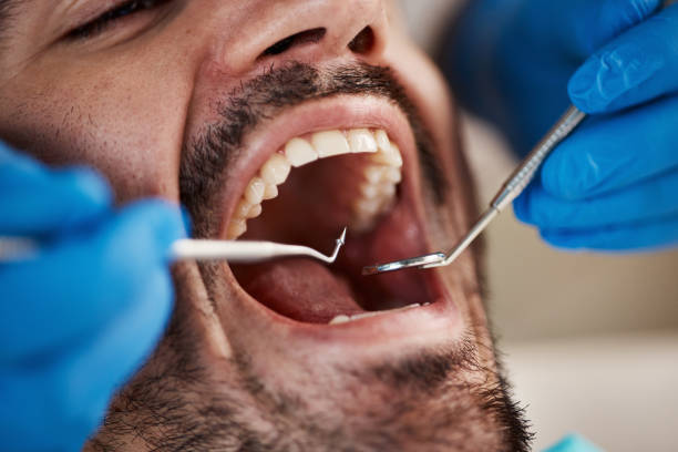 Professional Emergency Dentist in SC