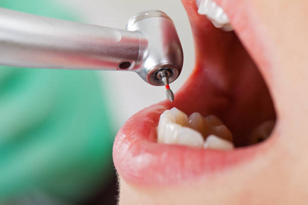 Best Emergency Treatment for Toothache in Hanahan, SC